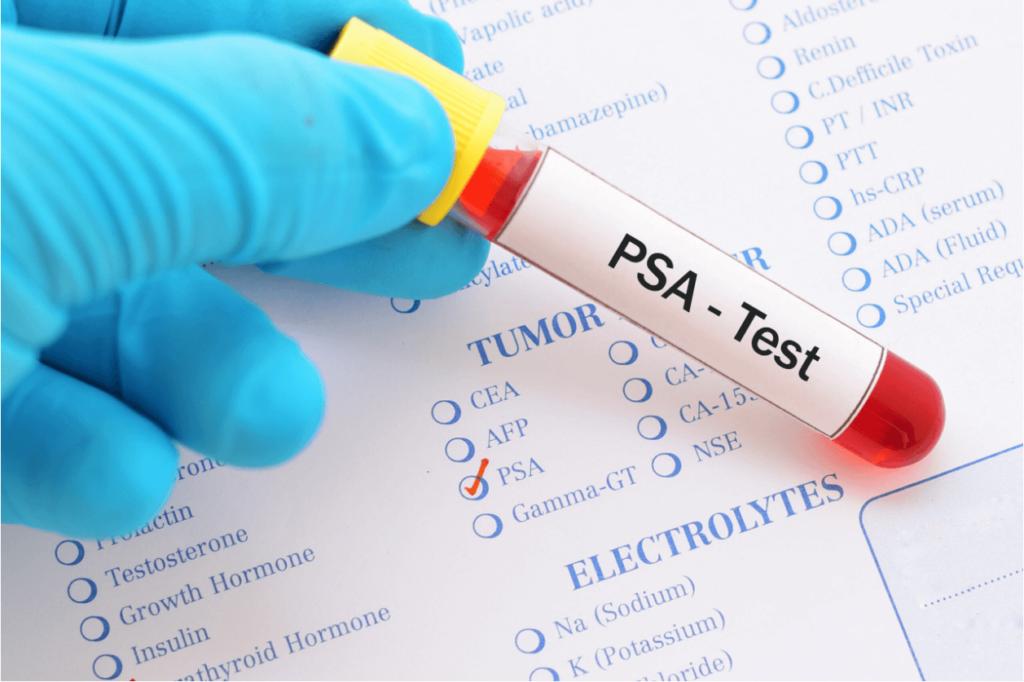 Teste PSA em Turmalina MG