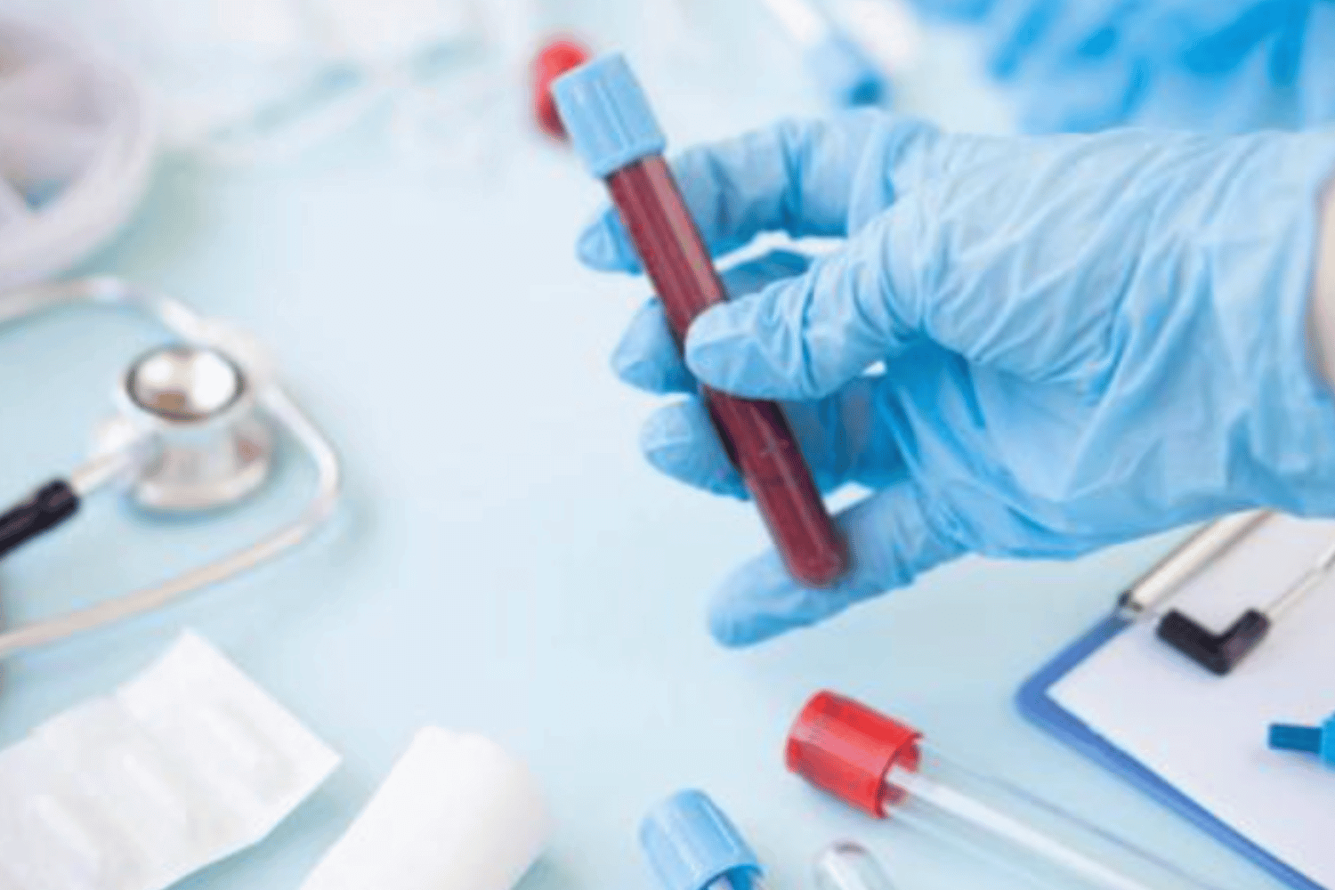 Exame de Sangue para Testosterona: Laboratório Santiago e Vilela