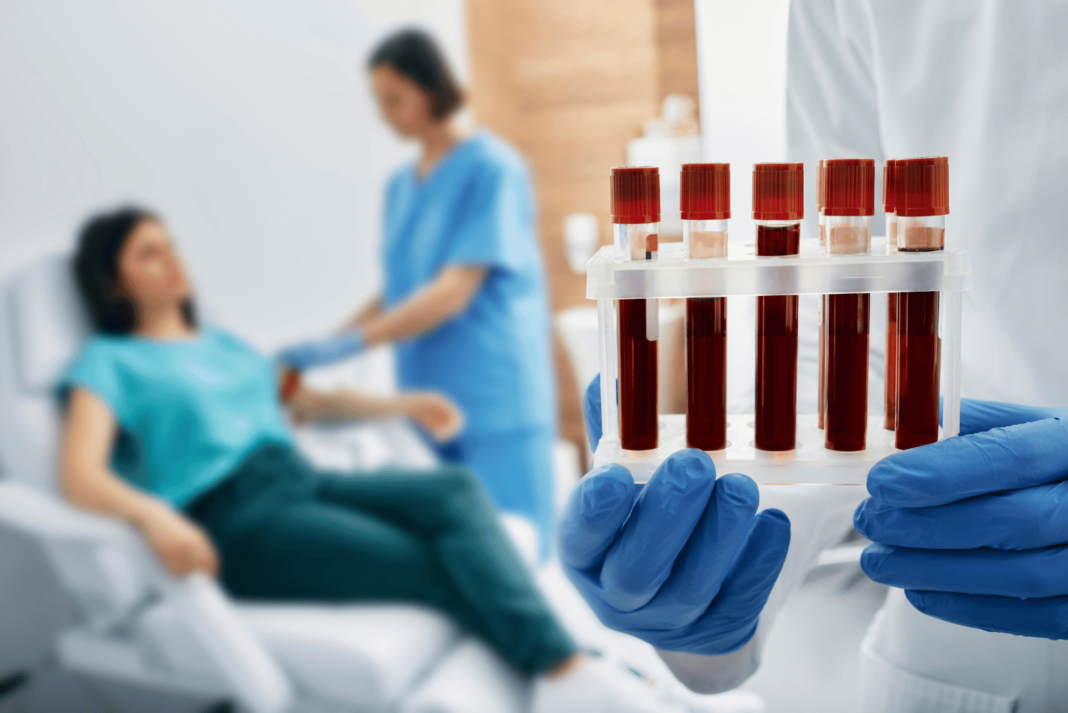 Teste Anticoagulante Lúpico (AL): Tudo que Você Precisa Saber